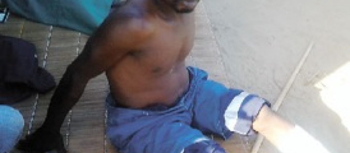 Jovem é espancado e queimado vivo na Matola